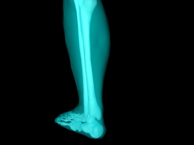 X Ray Ankle Joint Medically Accurate Model 3D model_33