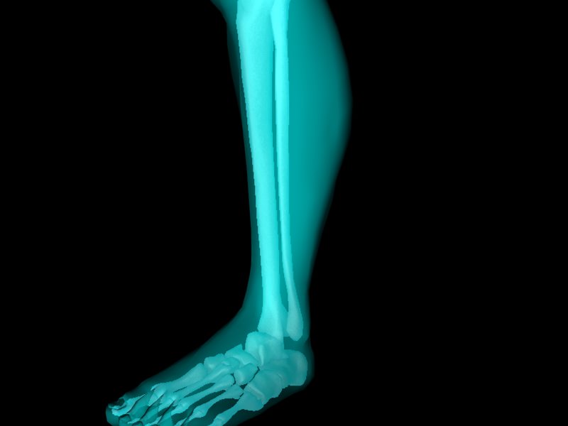 X Ray Ankle Joint Medically Accurate Model 3D model_42