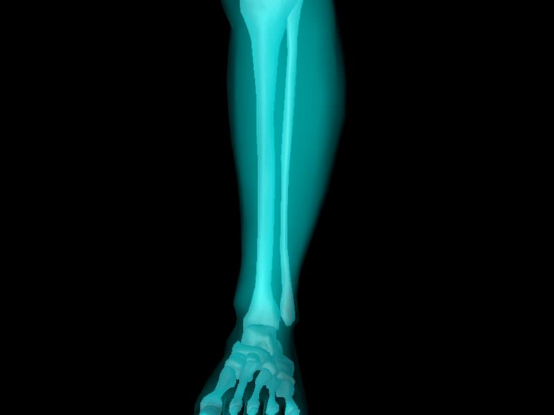 X Ray Ankle Joint Medically Accurate Model 3D model_49