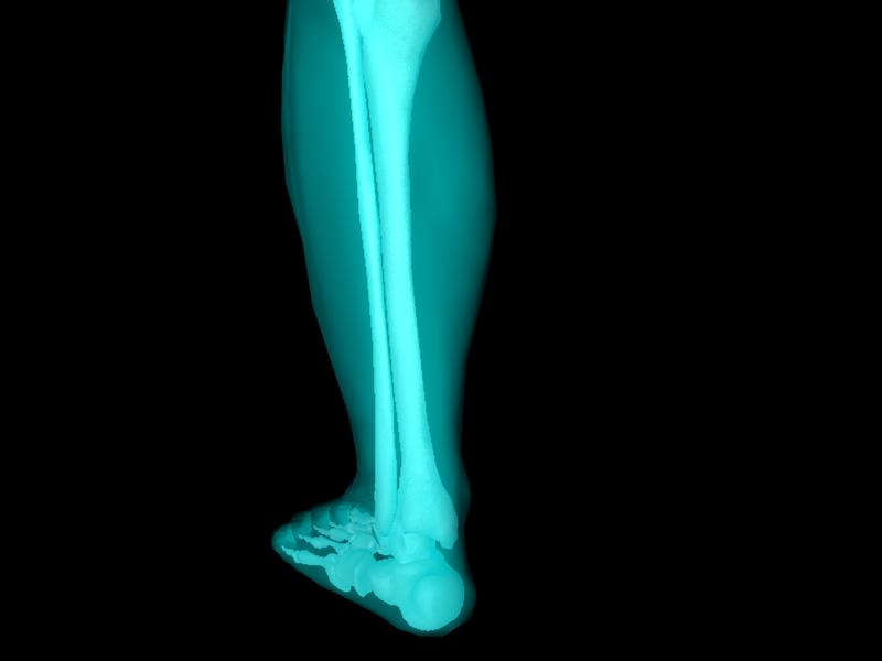 X Ray Ankle Joint Medically Accurate Model 3D model_30