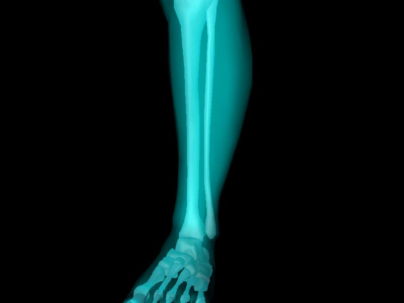 X Ray Ankle Joint Medically Accurate Model 3D model_47