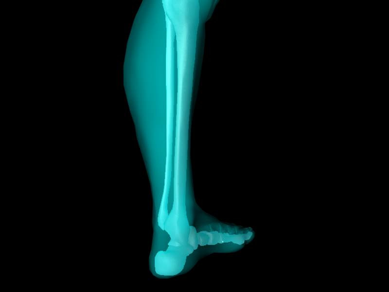 X Ray Ankle Joint Medically Accurate Model 3D model_22