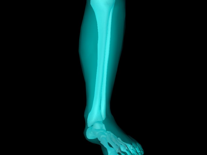 X Ray Ankle Joint Medically Accurate Model 3D model_9