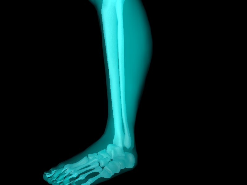 X Ray Ankle Joint Medically Accurate Model 3D model_41