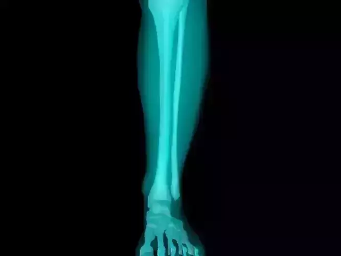 X Ray Ankle Joint Medically Accurate Model 3D model
