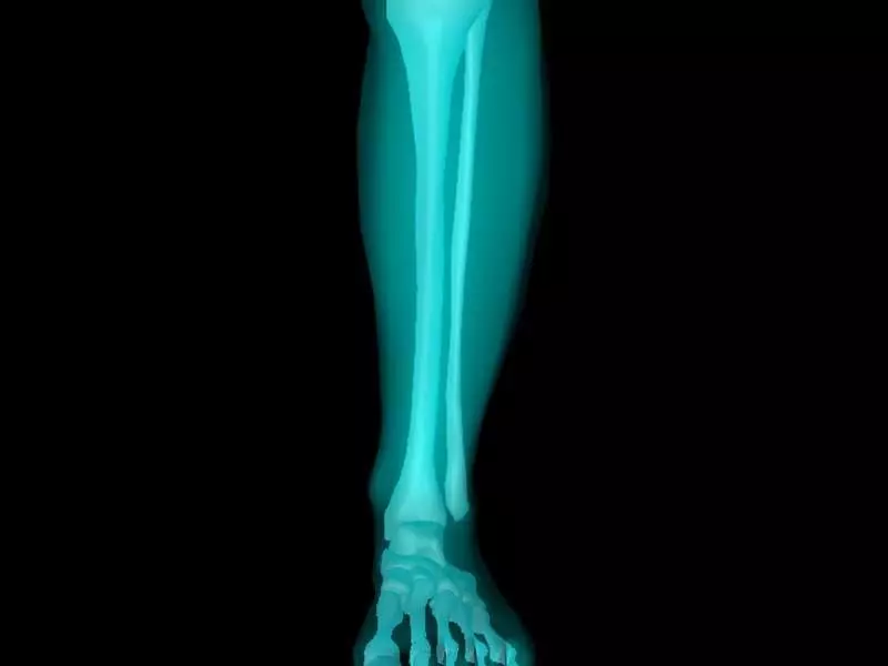 X Ray Ankle Joint Medically Accurate Model 3D model_0