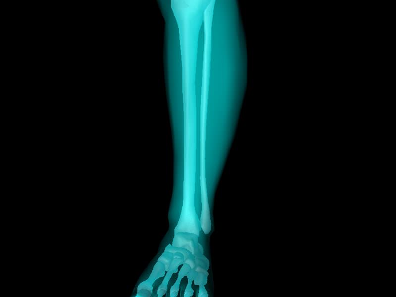 X Ray Ankle Joint Medically Accurate Model 3D model_48