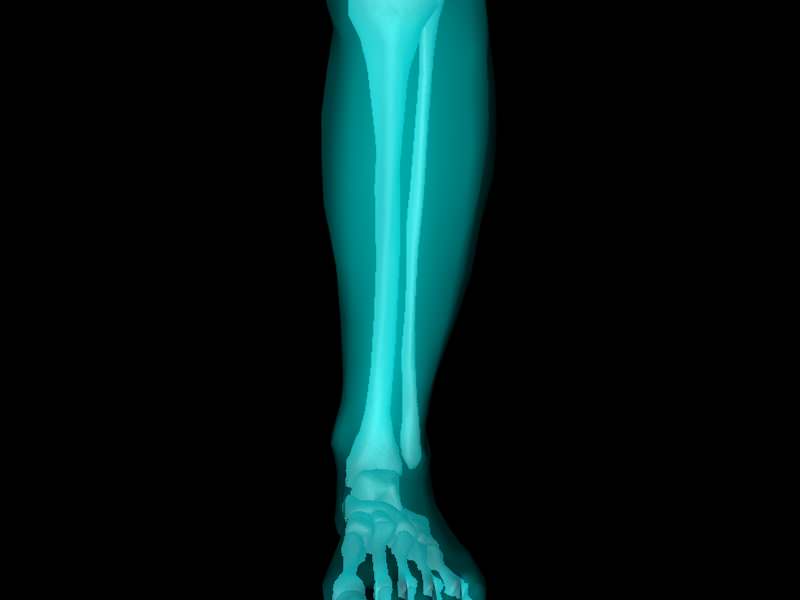 X Ray Ankle Joint Medically Accurate Model 3D model_2