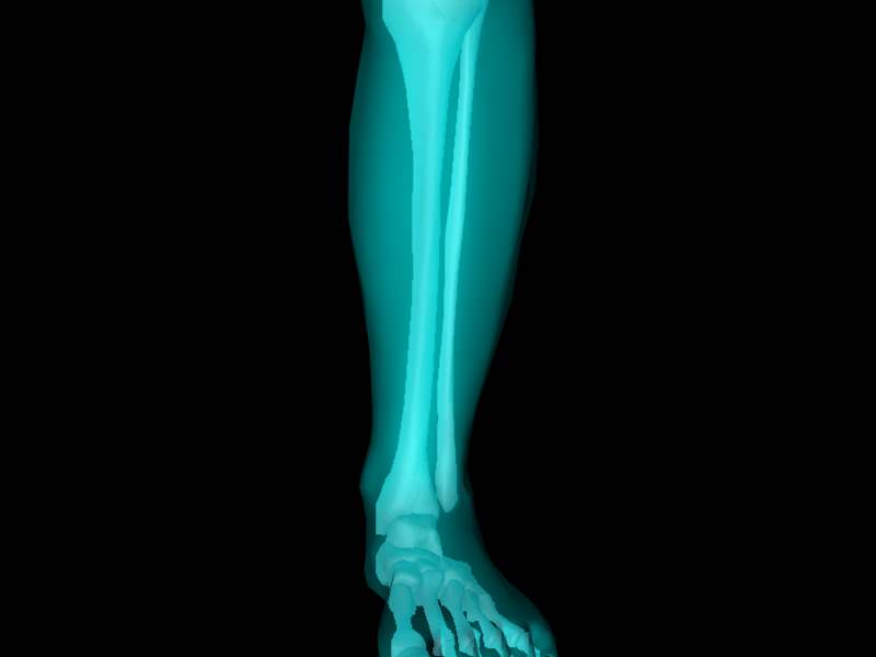 X Ray Ankle Joint Medically Accurate Model 3D model_5