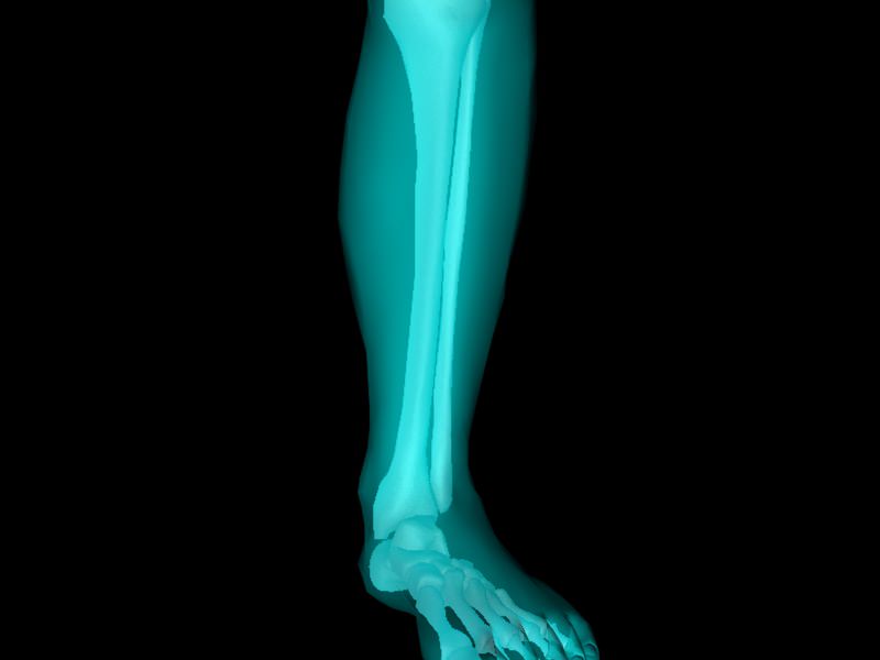 X Ray Ankle Joint Medically Accurate Model 3D model_7
