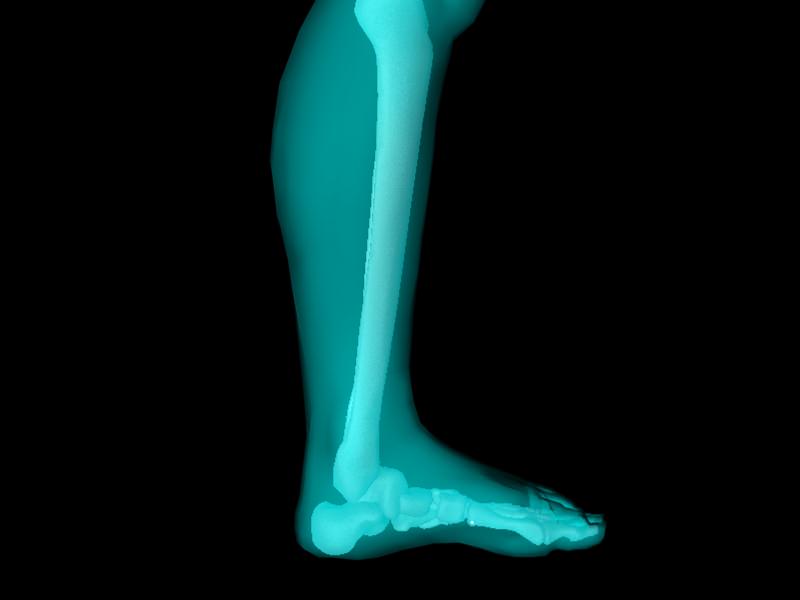 X Ray Ankle Joint Medically Accurate Model 3D model_17