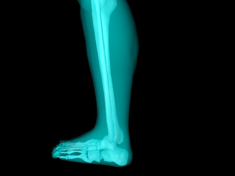X Ray Ankle Joint Medically Accurate Model 3D model_34
