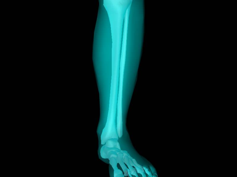 X Ray Ankle Joint Medically Accurate Model 3D model_8