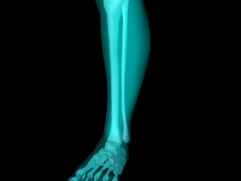 X Ray Ankle Joint Medically Accurate Model 3D model_45