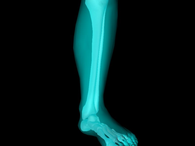 X Ray Ankle Joint Medically Accurate Model 3D model_11