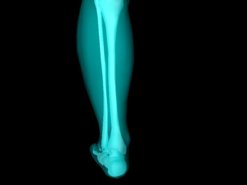 X Ray Ankle Joint Medically Accurate Model 3D model_28