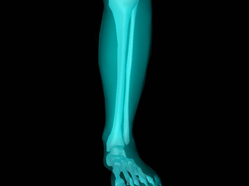 X Ray Ankle Joint Medically Accurate Model 3D model_6