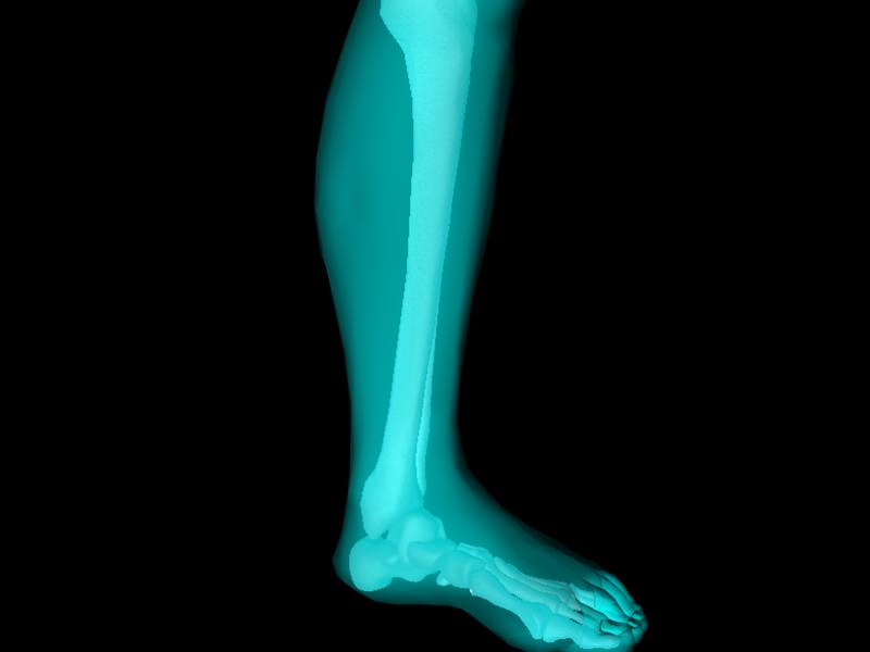 X Ray Ankle Joint Medically Accurate Model 3D model_14