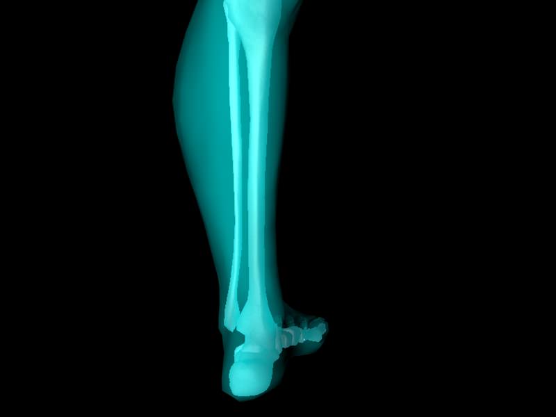 X Ray Ankle Joint Medically Accurate Model 3D model_25