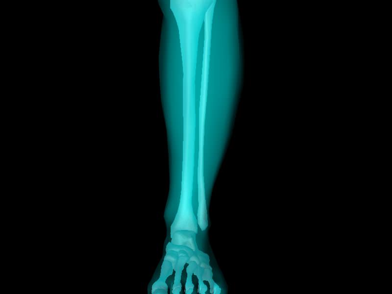 X Ray Ankle Joint Medically Accurate Model 3D model_51
