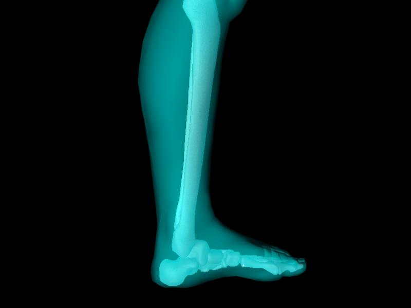 X Ray Ankle Joint Medically Accurate Model 3D model_19