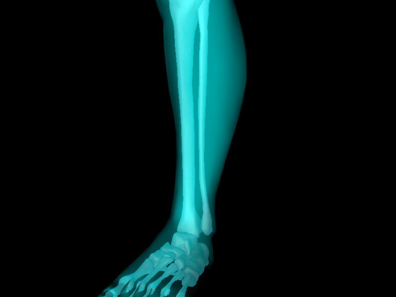 X Ray Ankle Joint Medically Accurate Model 3D model_46