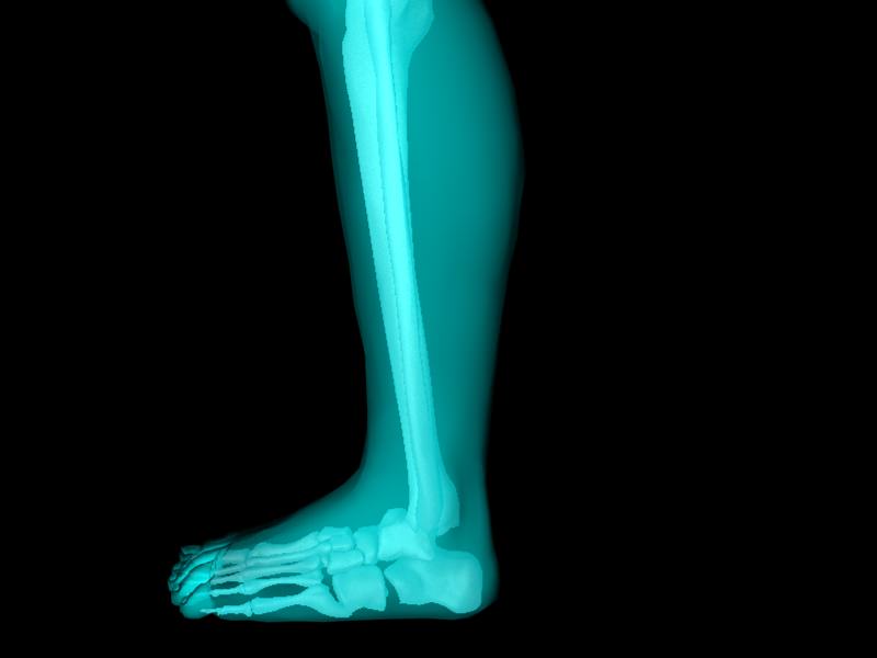 X Ray Ankle Joint Medically Accurate Model 3D model_36