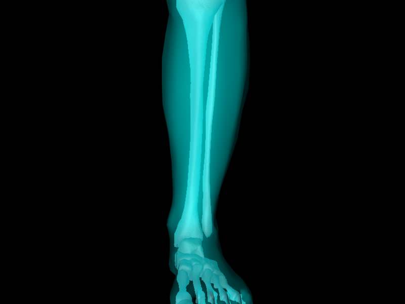 X Ray Ankle Joint Medically Accurate Model 3D model_4