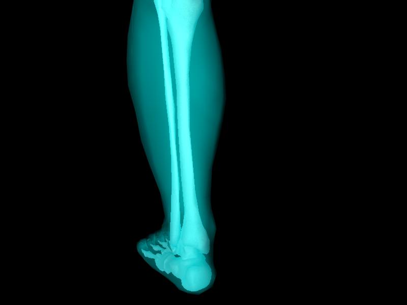 X Ray Ankle Joint Medically Accurate Model 3D model_29