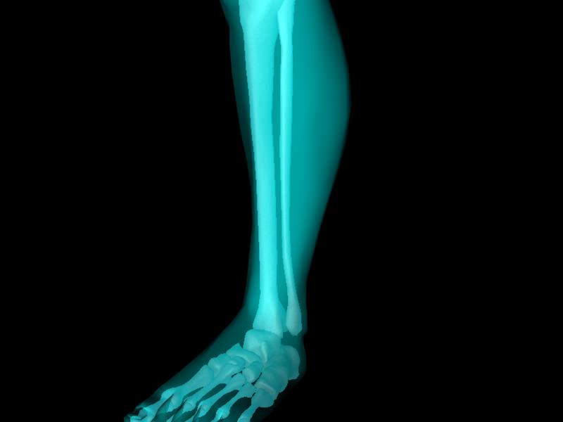 X Ray Ankle Joint Medically Accurate Model 3D model_44