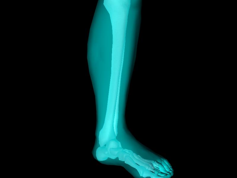 X Ray Ankle Joint Medically Accurate Model 3D model_12