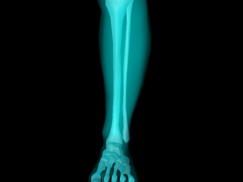 X Ray Ankle Joint Medically Accurate Model 3D model_50