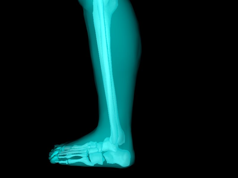 X Ray Ankle Joint Medically Accurate Model 3D model_35