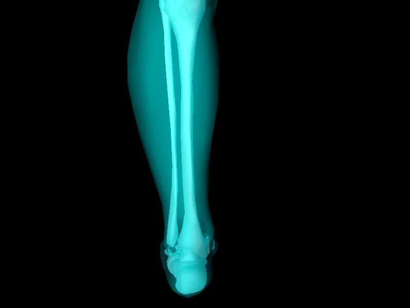 X Ray Ankle Joint Medically Accurate Model 3D model_26