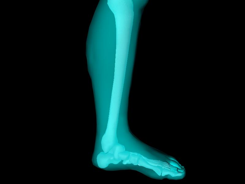 X Ray Ankle Joint Medically Accurate Model 3D model_16