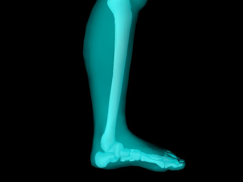X Ray Ankle Joint Medically Accurate Model 3D model_18