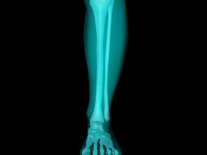 X Ray Ankle Joint Medically Accurate Model 3D model_52