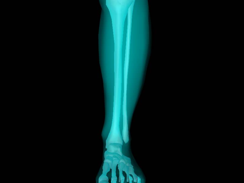 X Ray Ankle Joint Medically Accurate Model 3D model_53