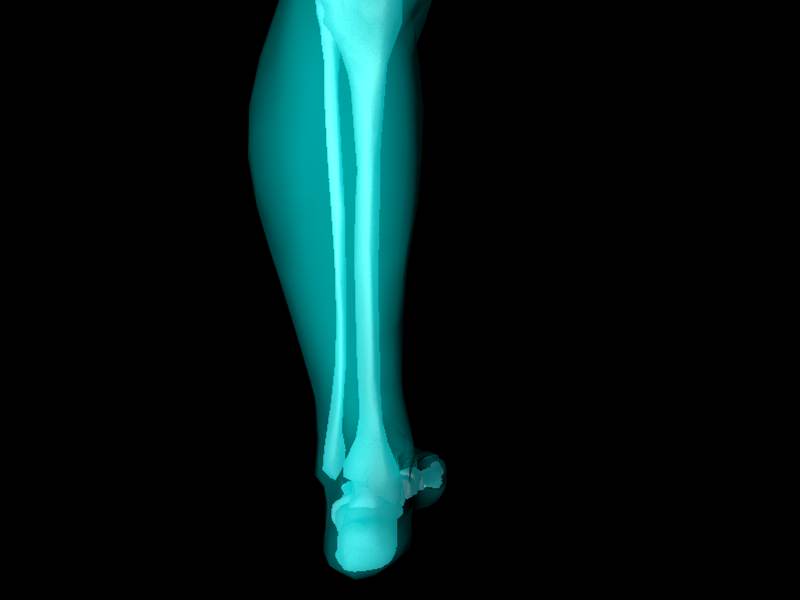 X Ray Ankle Joint Medically Accurate Model 3D model_27