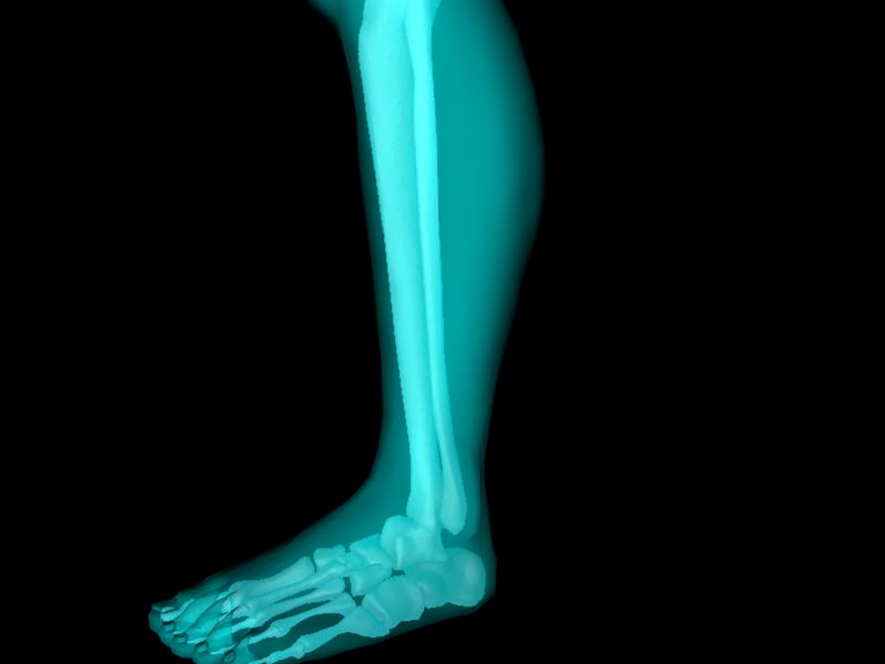 X Ray Ankle Joint Medically Accurate Model 3D model_40