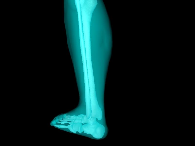 X Ray Ankle Joint Medically Accurate Model 3D model_31