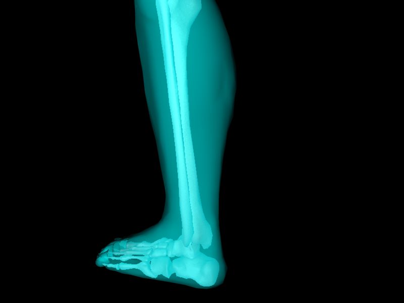 X Ray Ankle Joint Medically Accurate Model 3D model_32