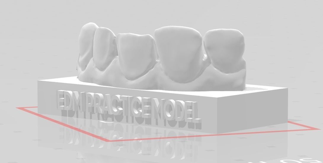EDM Dental Practice Standard Model Direct Veneer  Sample 3D print model_3