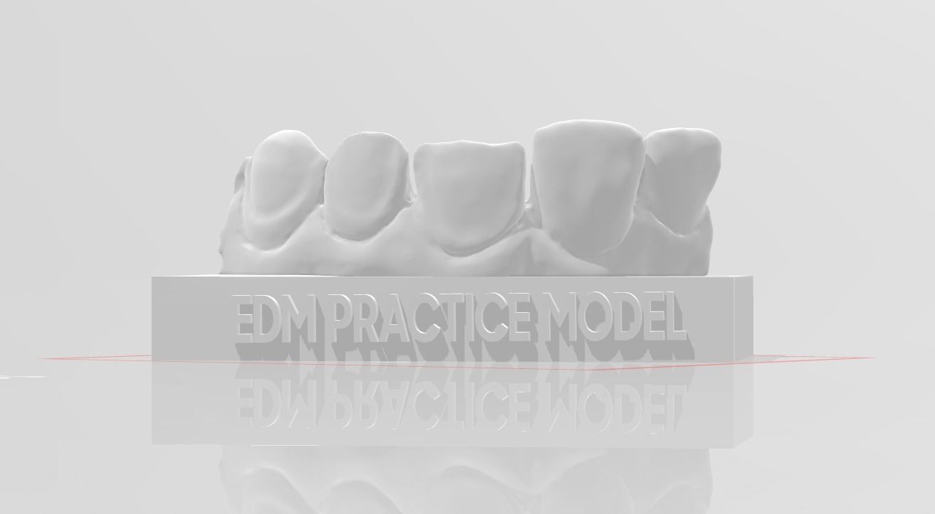 EDM Dental Practice Standard Model Direct Veneer  Sample 3D print model_1