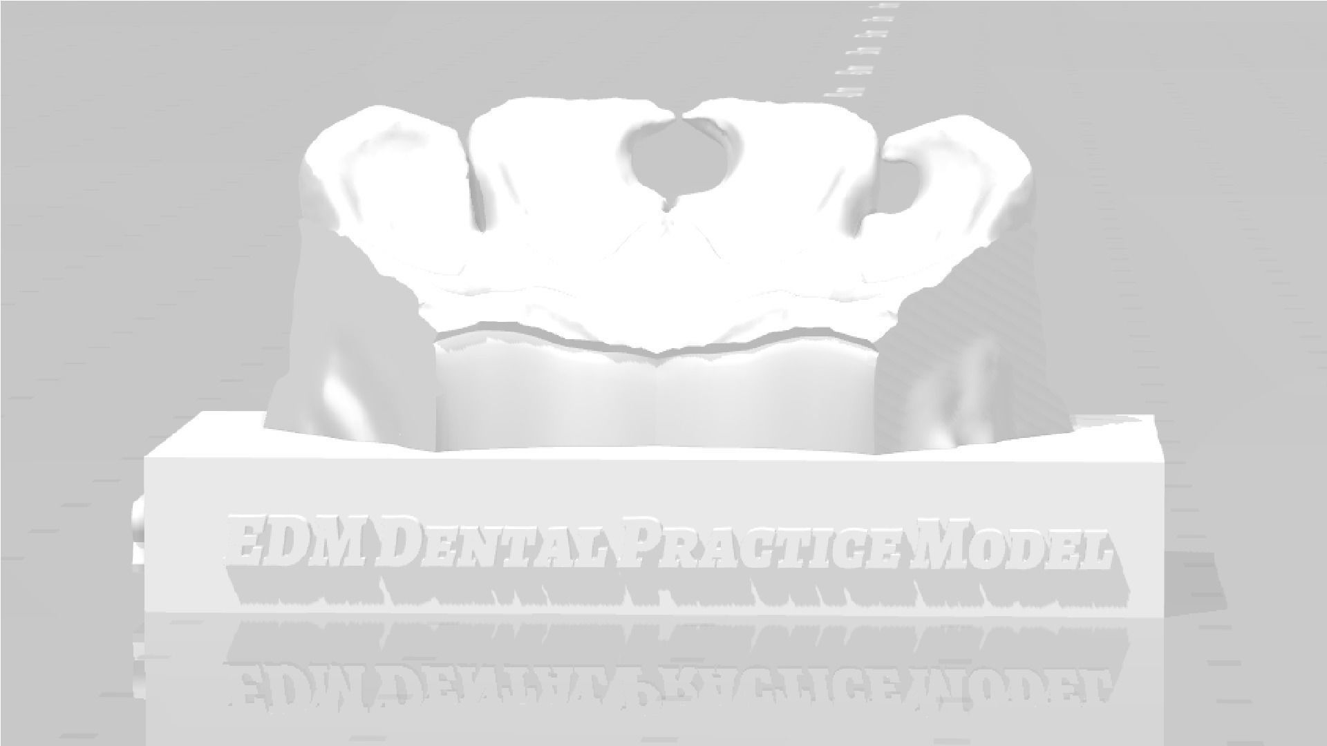 EDM Dental Practice Standard Upper Model Class 3 3D print model_2