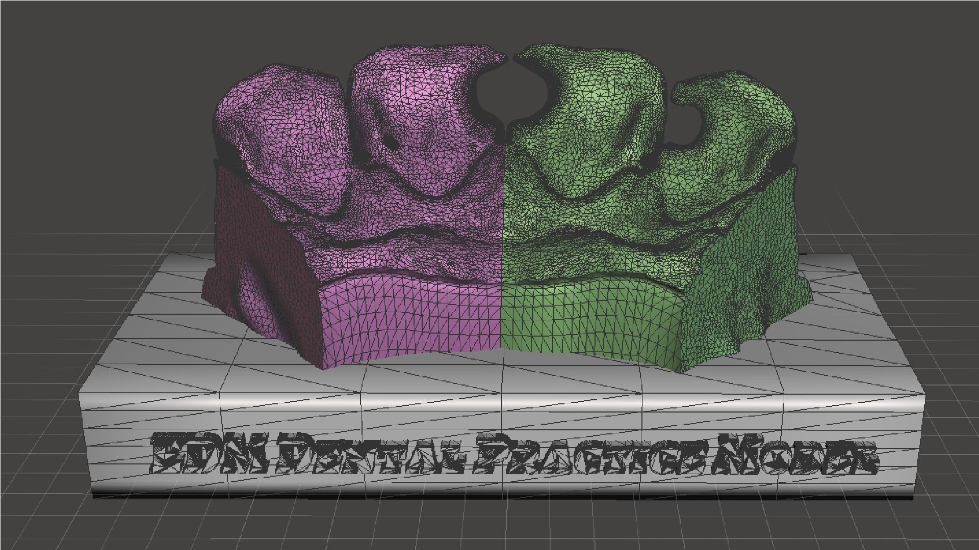 EDM Dental Practice Standard Upper Model Class 3 3D print model_9