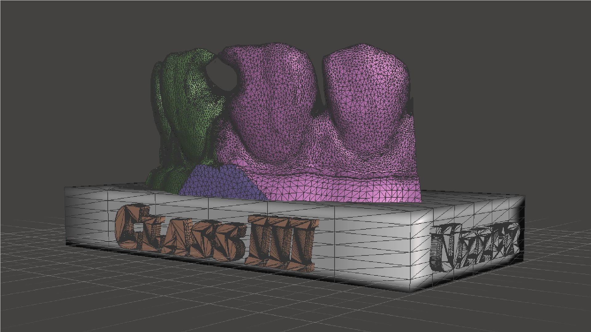 EDM Dental Practice Standard Upper Model Class 3 3D print model_8