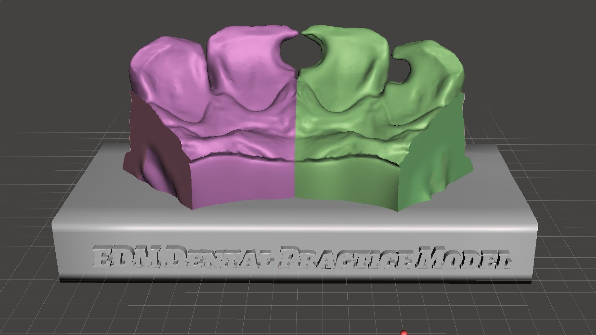 EDM Dental Practice Standard Upper Model Class 3 3D print model_3