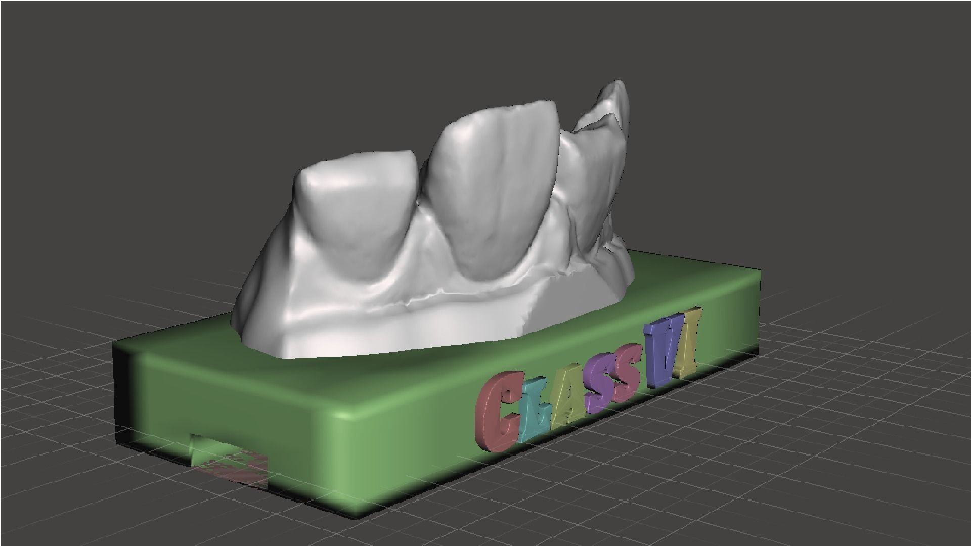 EDM Dental Practice Standard Upper Model Class 6 3D print model_6
