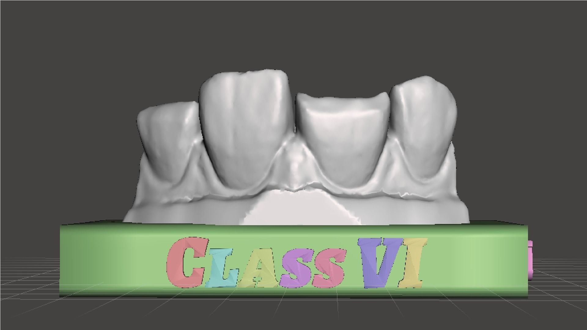 EDM Dental Practice Standard Upper Model Class 6 3D print model_1